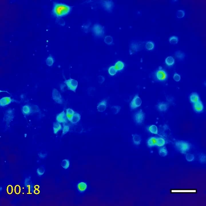 Neuronal calcium activity during ultrasound stimulation