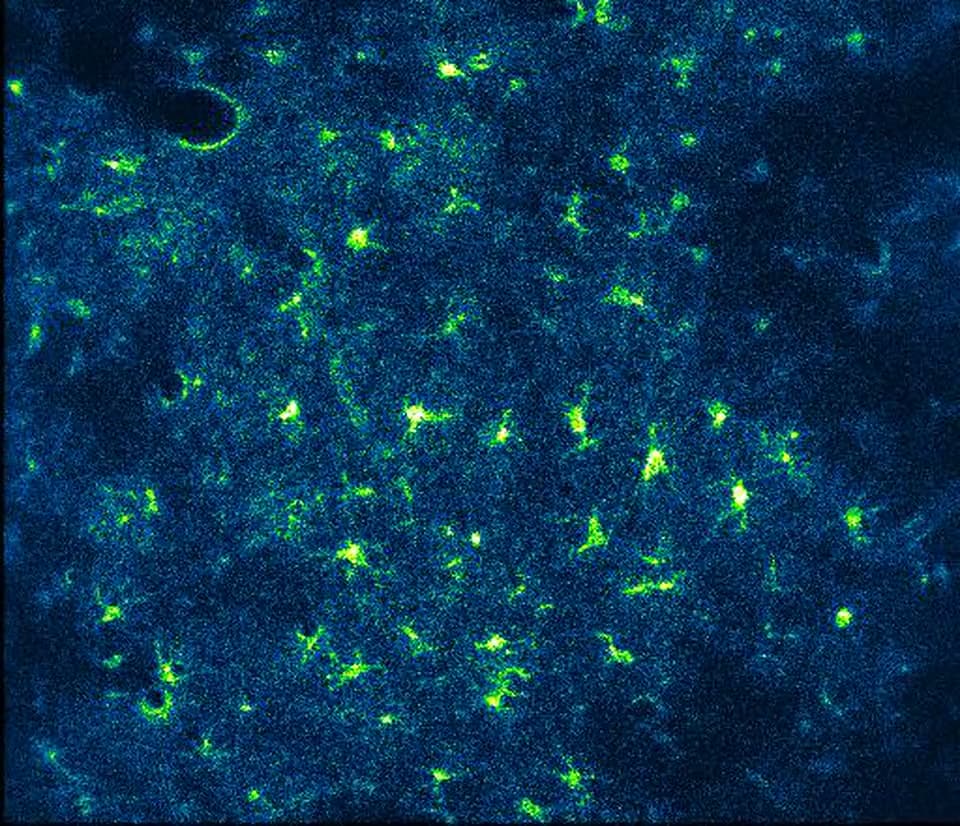Calcium activity in mouse cortical astrocytes